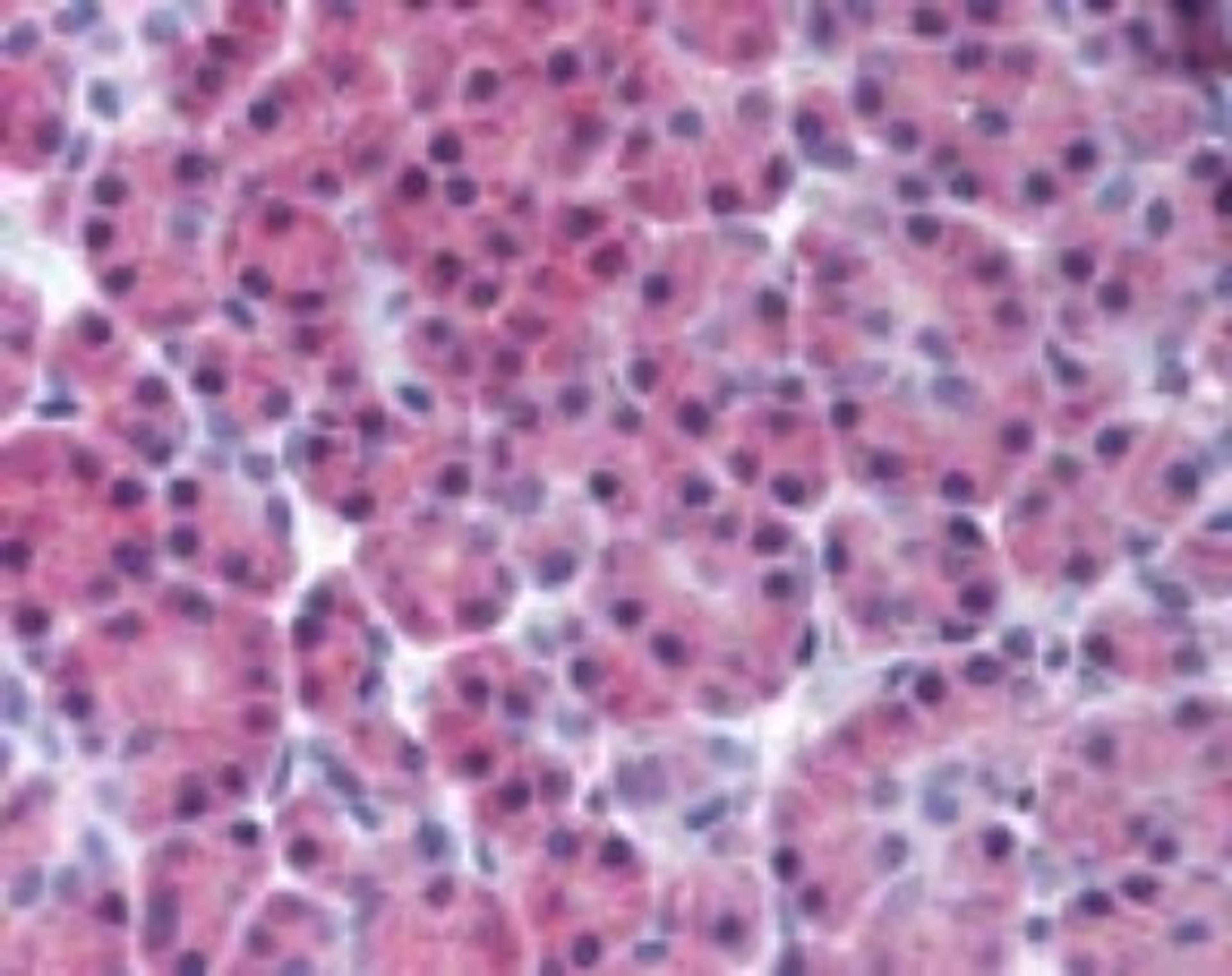 Immunohistochemistry-Paraffin: RIPK3 Antibody [NBP2-24588] - Analysis of RIP3 using RIP3 polyclonal antibody. Human pancreas probed with RIP3 antibody at 10 ug/ml.