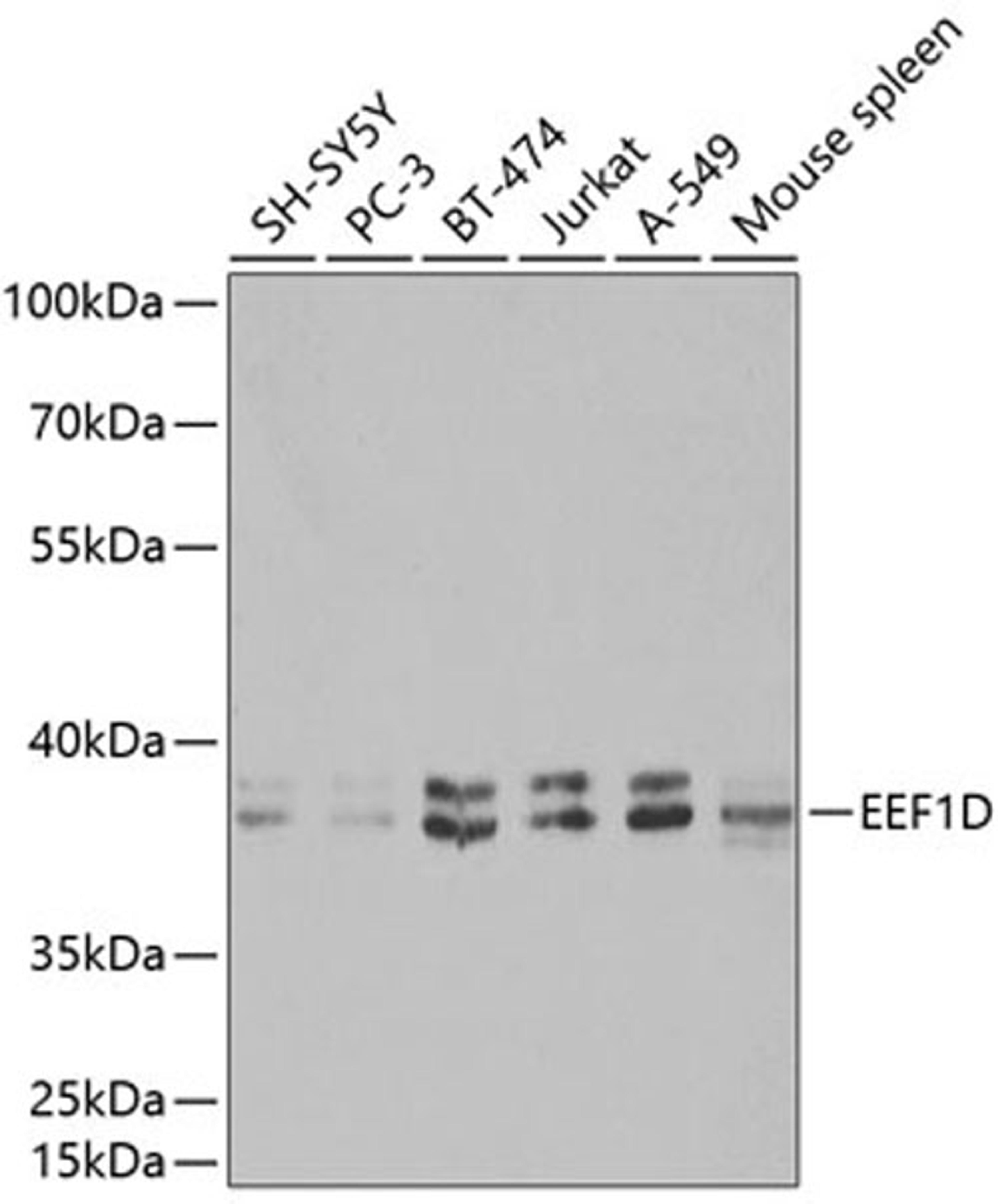 Western blot - EEF1D antibody (A2509)