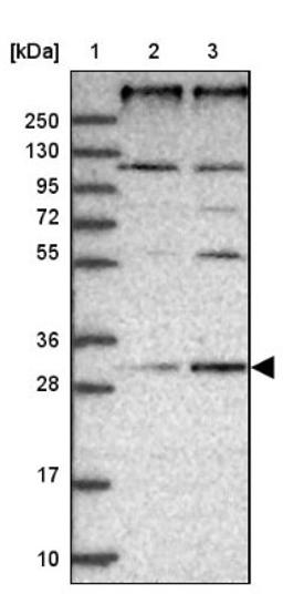 Western Blot: REEP4 Antibody [NBP2-34081] - Lane 1: Marker [kDa] 250, 130, 95, 72, 55, 36, 28, 17, 10<br/>Lane 2: Human cell line RT-4<br/>Lane 3: Human cell line U-251MG sp