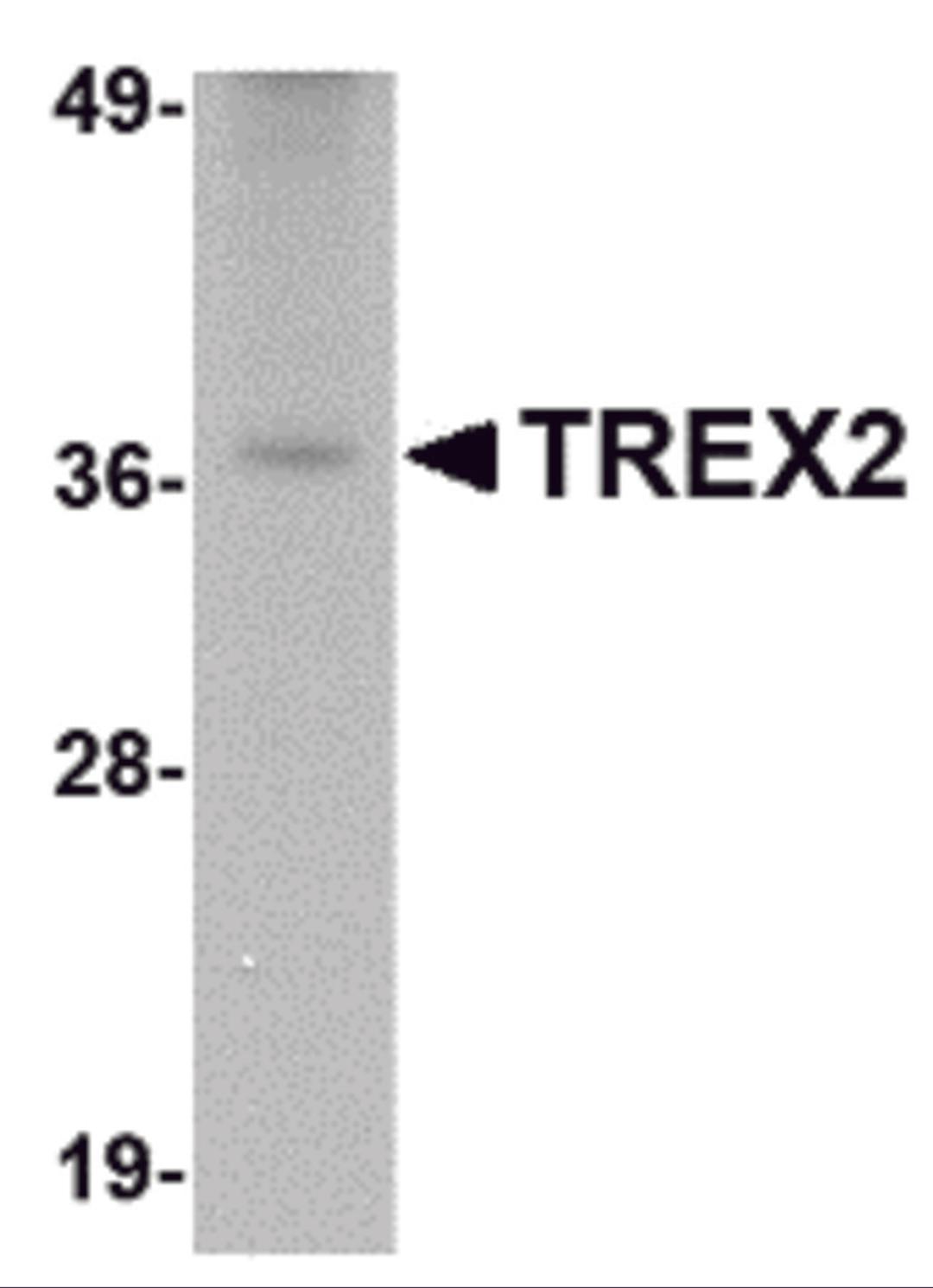 Western blot analysis of TREX2 in rat liver tissue lysate with TREX2 antibody at 2.5 μg/mL.