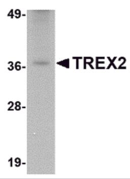 Western blot analysis of TREX2 in rat liver tissue lysate with TREX2 antibody at 2.5 μg/mL.
