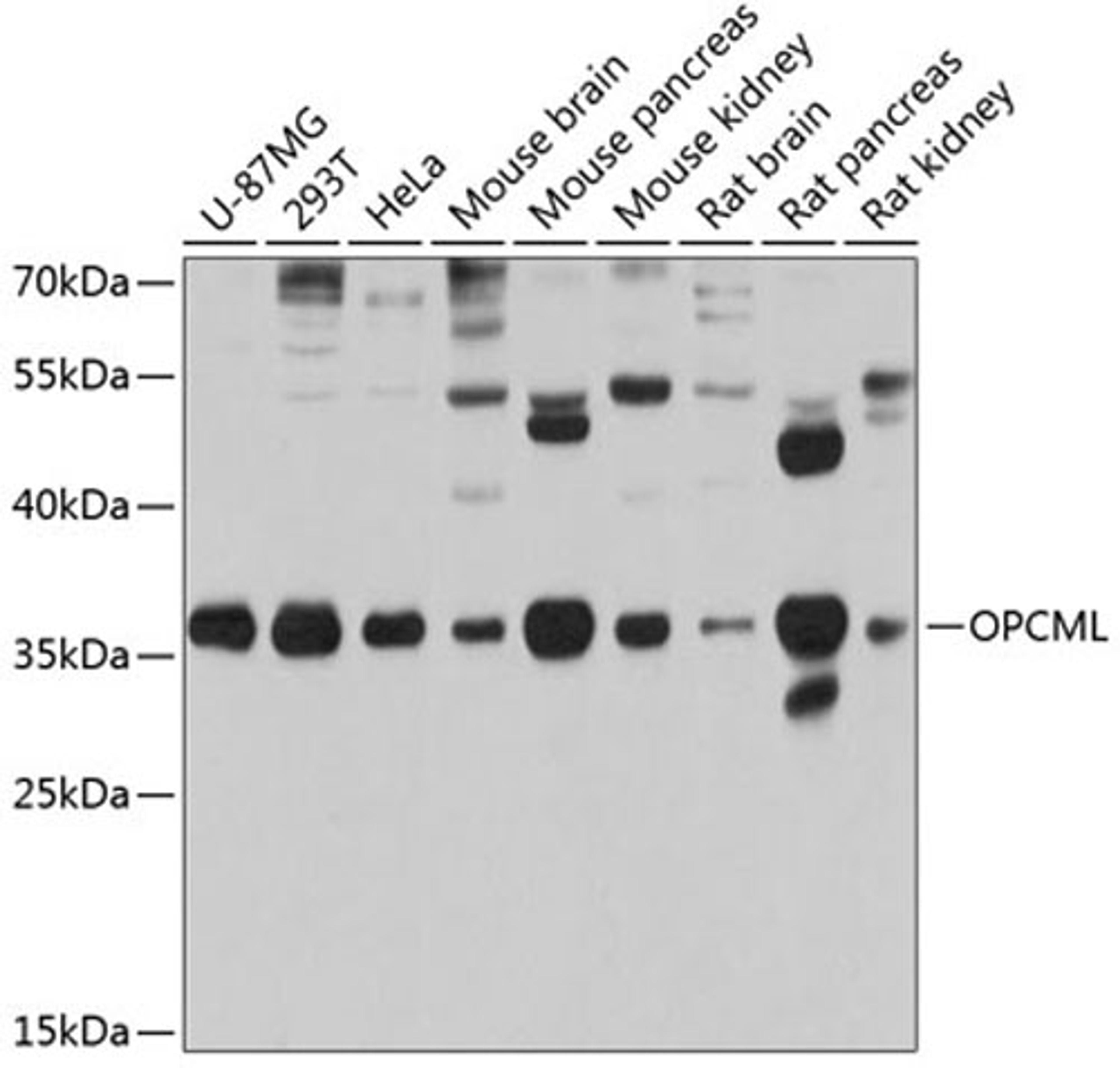 Western blot - OPCML antibody (A2778)