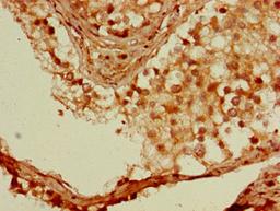 Immunohistochemistry of paraffin-embedded human testis tissue using CSB-PA614964LA01HU at dilution of 1:100