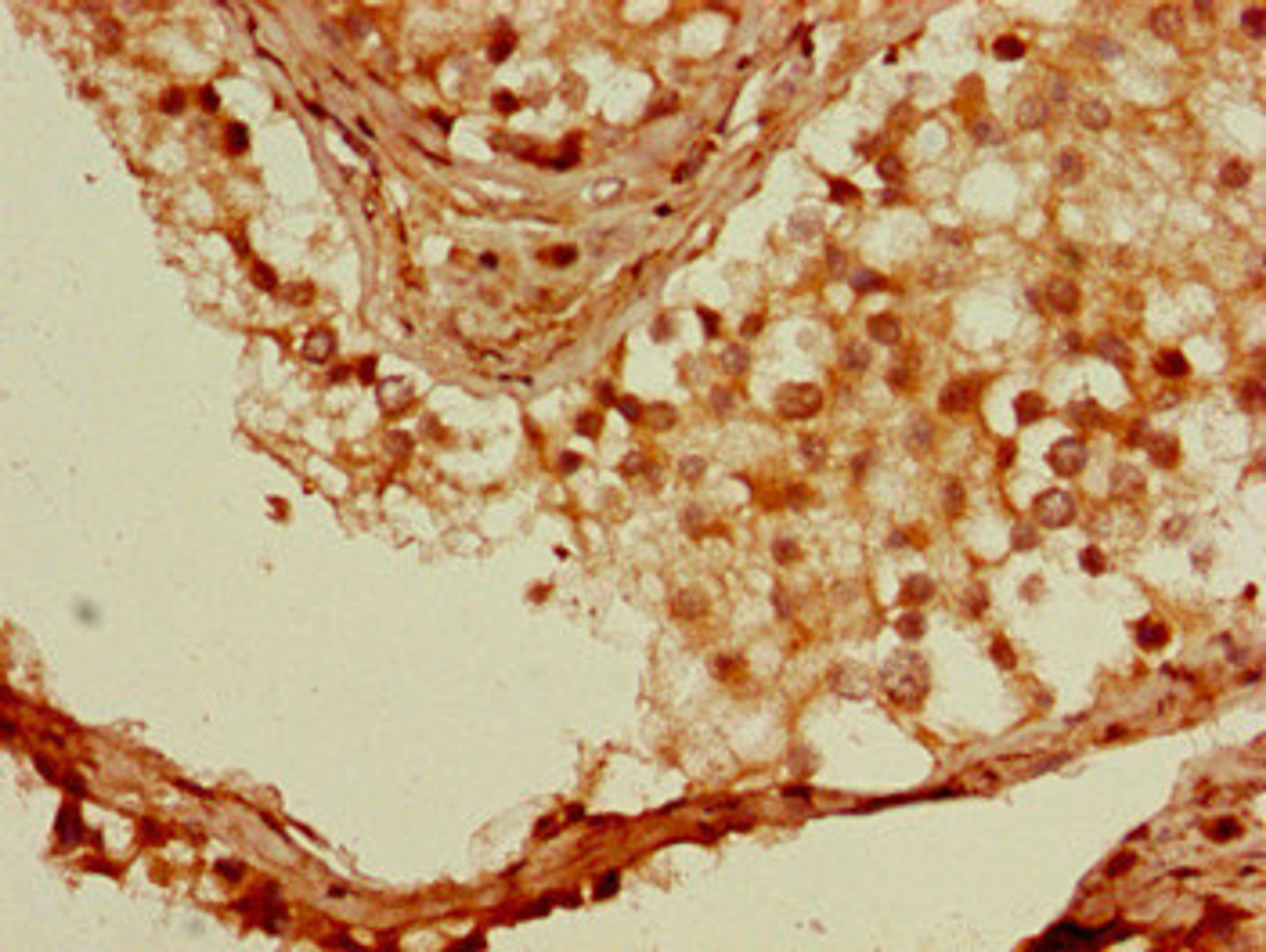 Immunohistochemistry of paraffin-embedded human testis tissue using CSB-PA614964LA01HU at dilution of 1:100