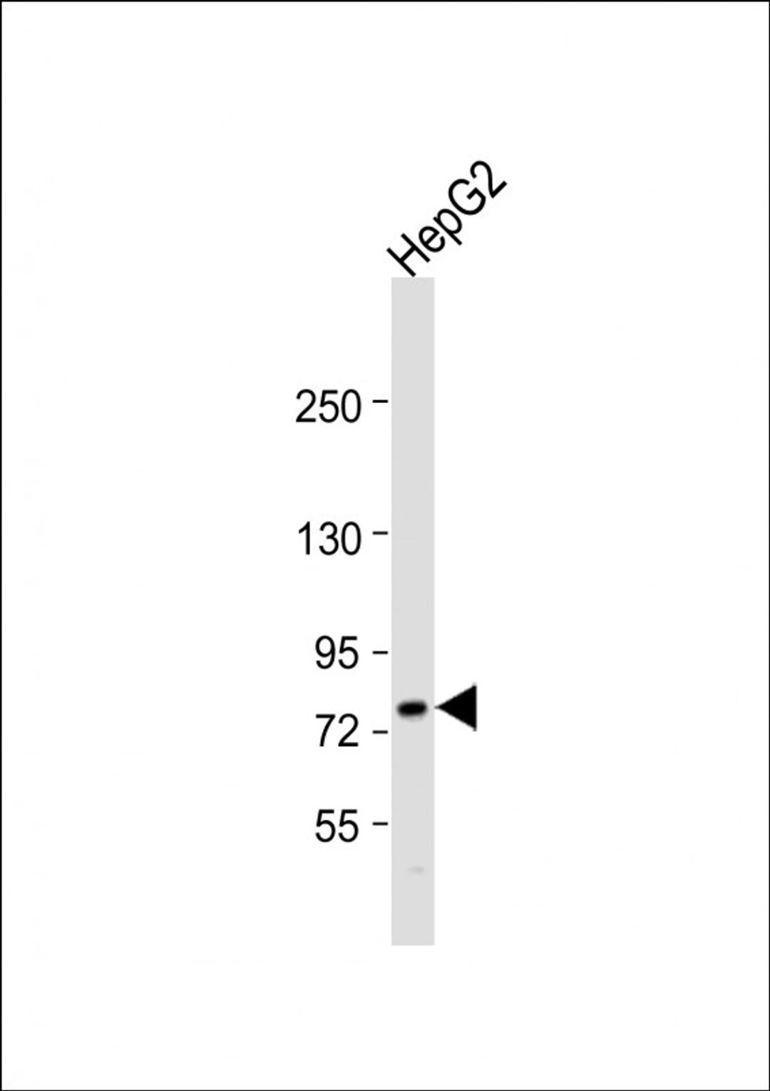 Western Blot at 1:1000 dilution + HepG2 whole cell lysate Lysates/proteins at 20 ug per lane.