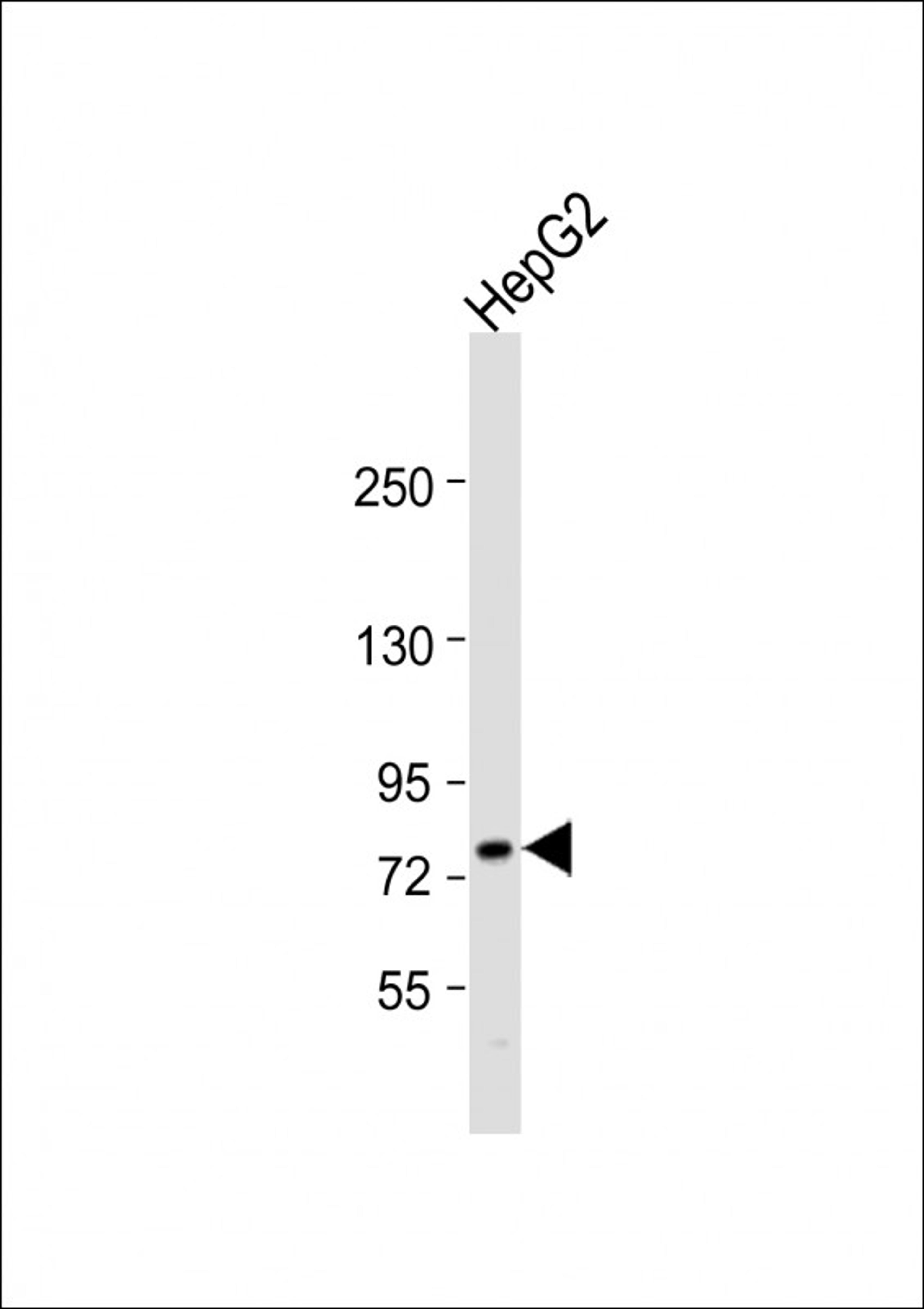 Western Blot at 1:1000 dilution + HepG2 whole cell lysate Lysates/proteins at 20 ug per lane.