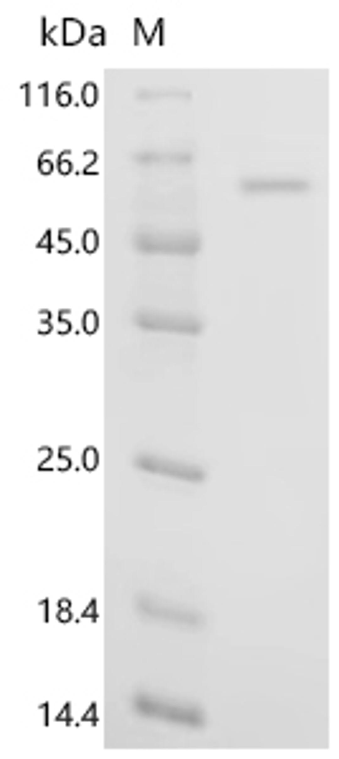 (Tris-Glycine gel) Discontinuous SDS-PAGE (reduced) with 5% enrichment gel and 15% separation gel.