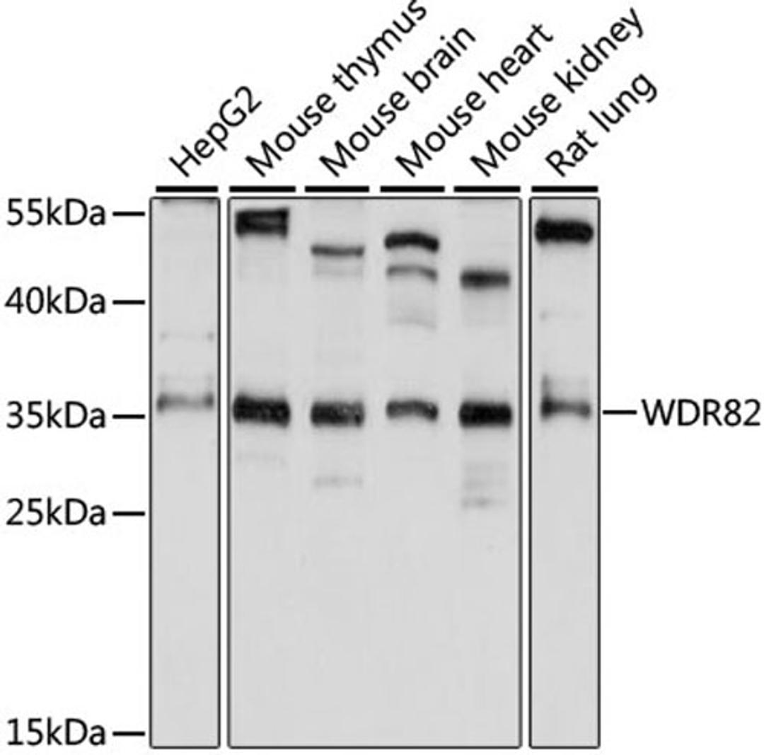 Western blot - WDR82 antibody (A15518)