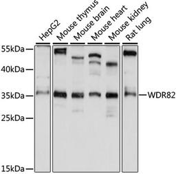 Western blot - WDR82 antibody (A15518)