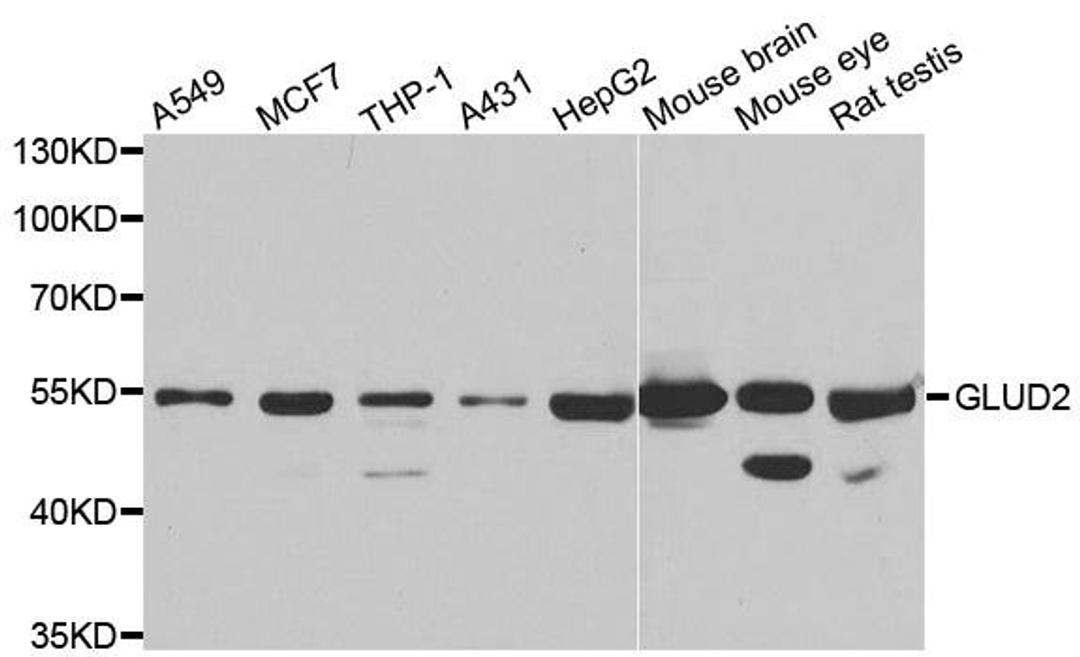 Western blot analysis of extracts of various cell lines using GLUD2 antibody