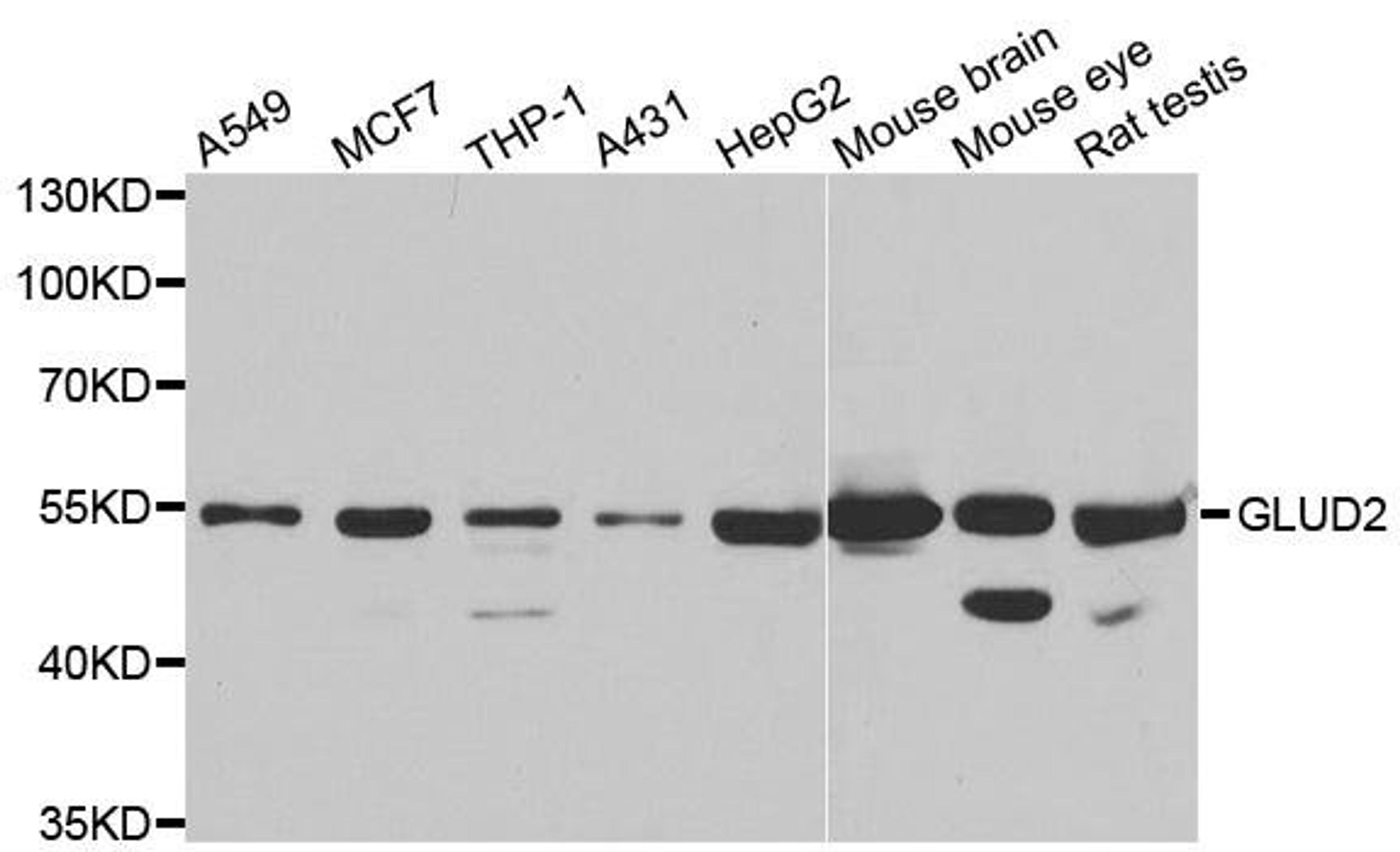 Western blot analysis of extracts of various cell lines using GLUD2 antibody