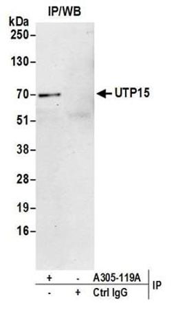 Detection of human UTP15 by western blot of immunoprecipitates.