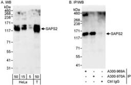 Detection of human SAPS2 by western blot and immunoprecipitation.