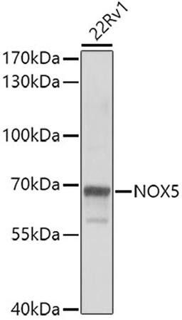 Western blot - NOX5 antibody (A7136)