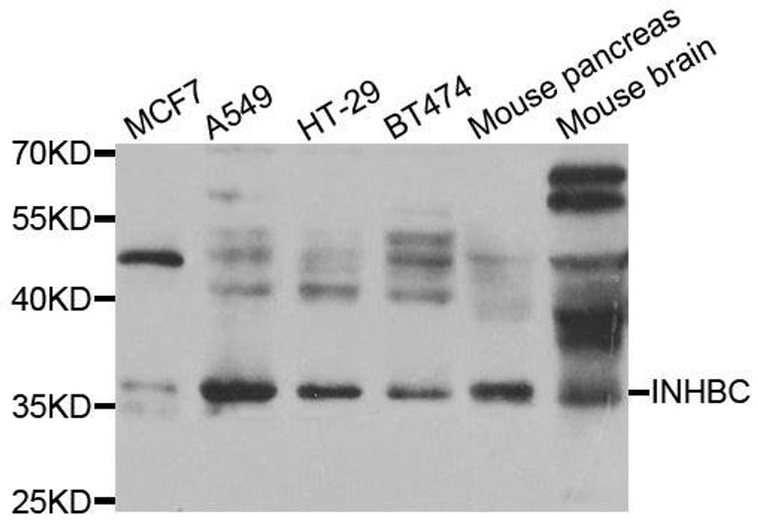 Western blot analysis of extracts of various cell lines using INHBC antibody