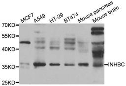 Western blot analysis of extracts of various cell lines using INHBC antibody