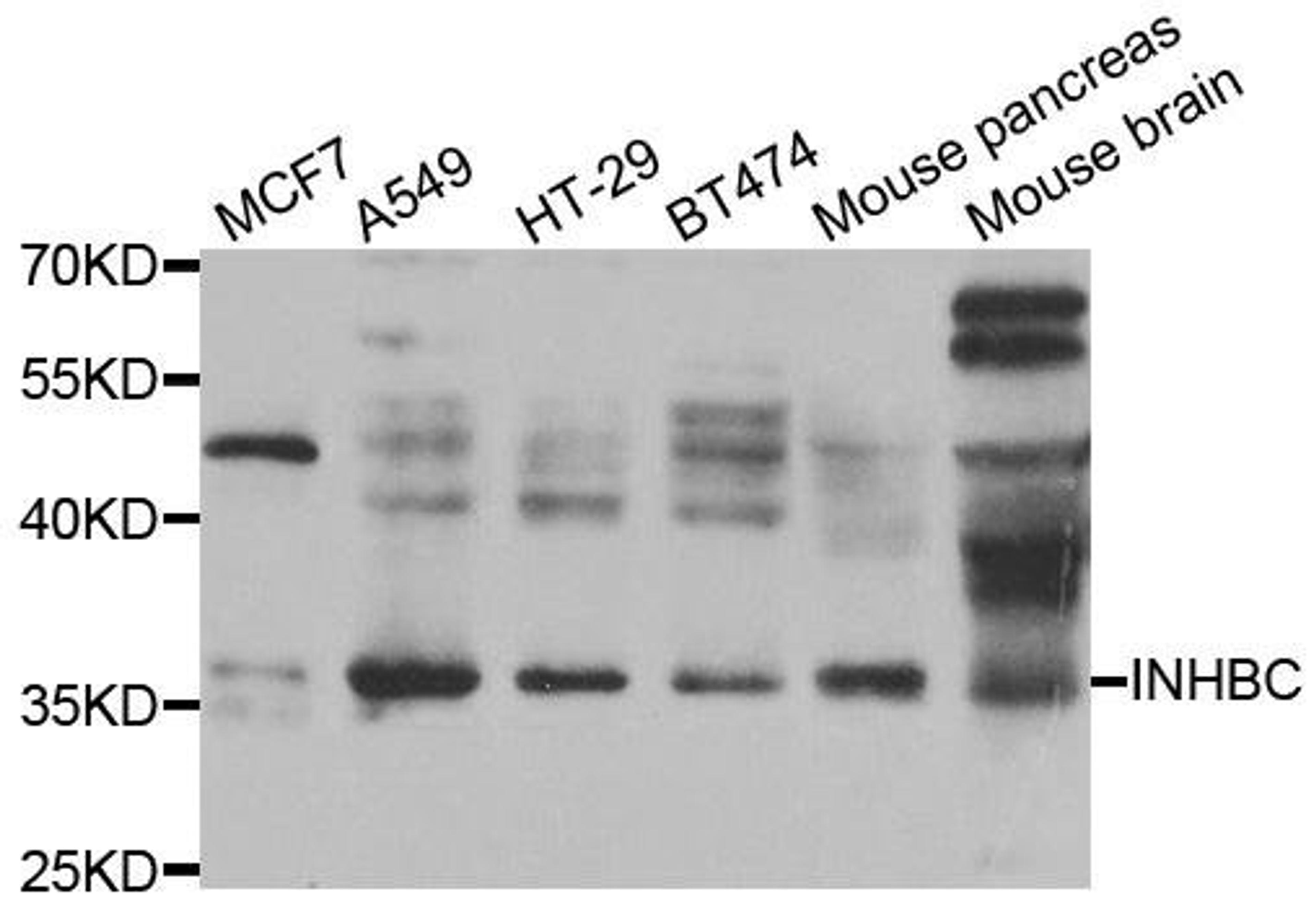 Western blot analysis of extracts of various cell lines using INHBC antibody