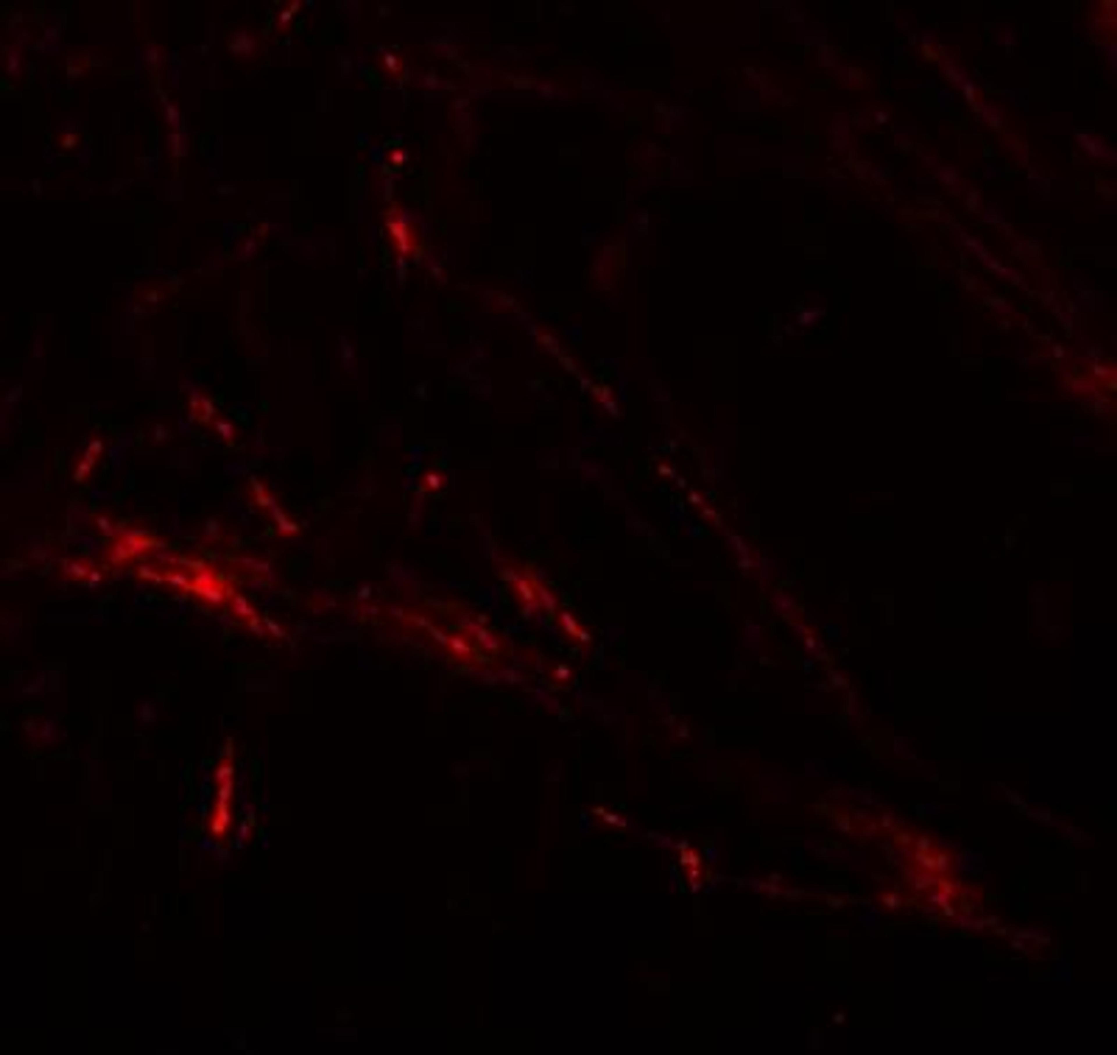 Immunocytochemistry/Immunofluorescence: SLC39A7/ZIP7 Antibody [NBP1-76504] - Immunofluorescence of ZIP7 in human brain tissue with ZIP7 antibody at 20 ug/mL.