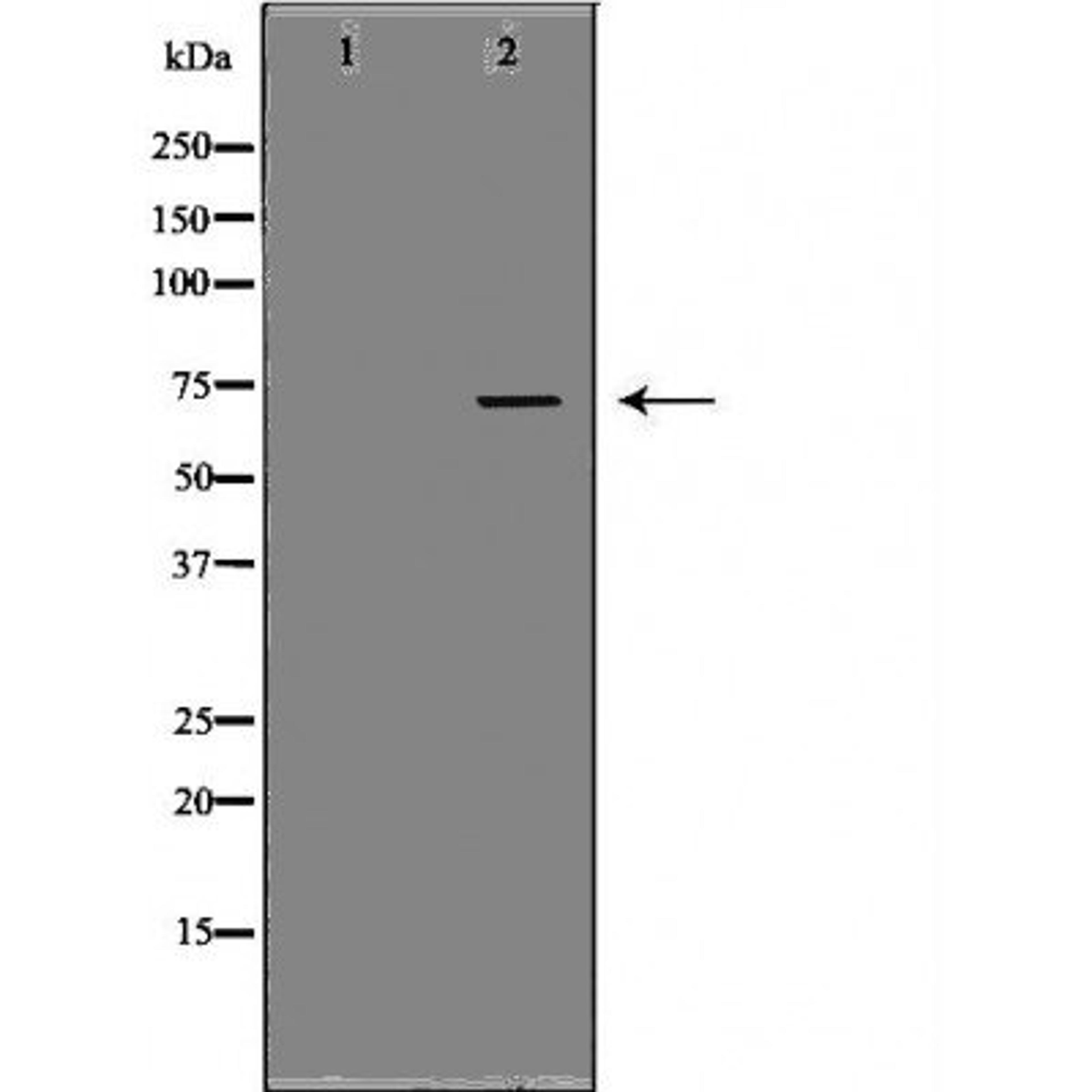 Western blot analysis of human placenta tissue using PROS1 antibody