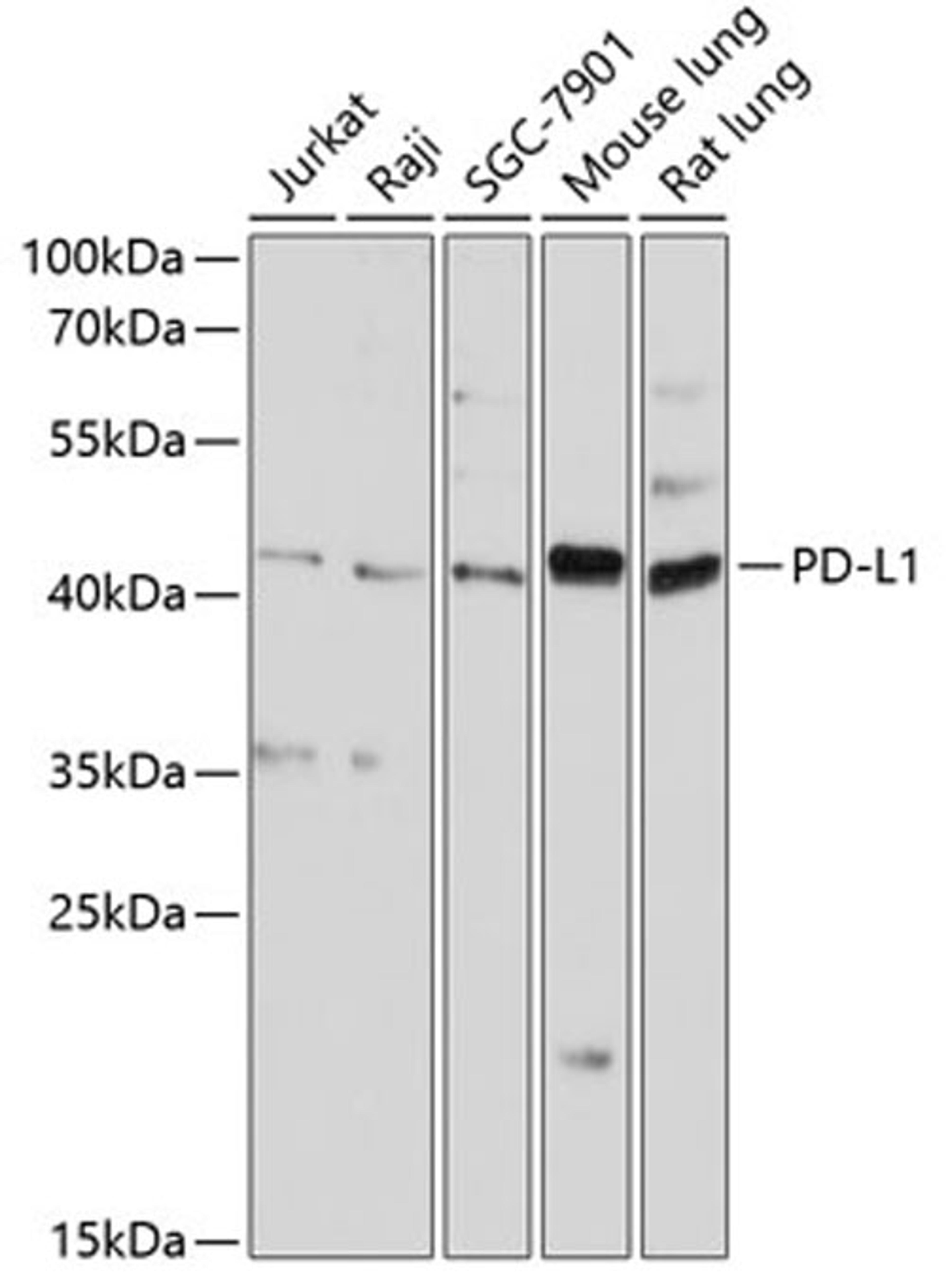 Western blot - PD-L1 antibody (A1645)