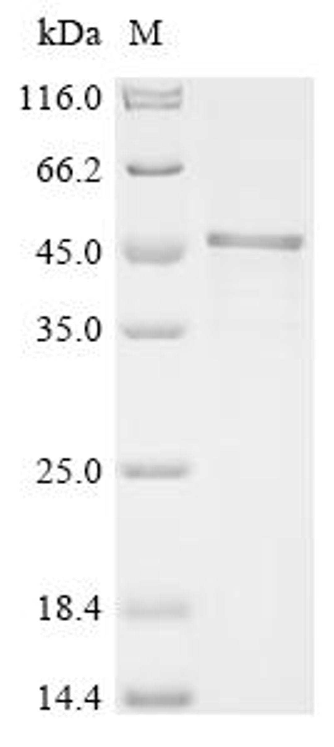 (Tris-Glycine gel) Discontinuous SDS-PAGE (reduced) with 5% enrichment gel and 15% separation gel.