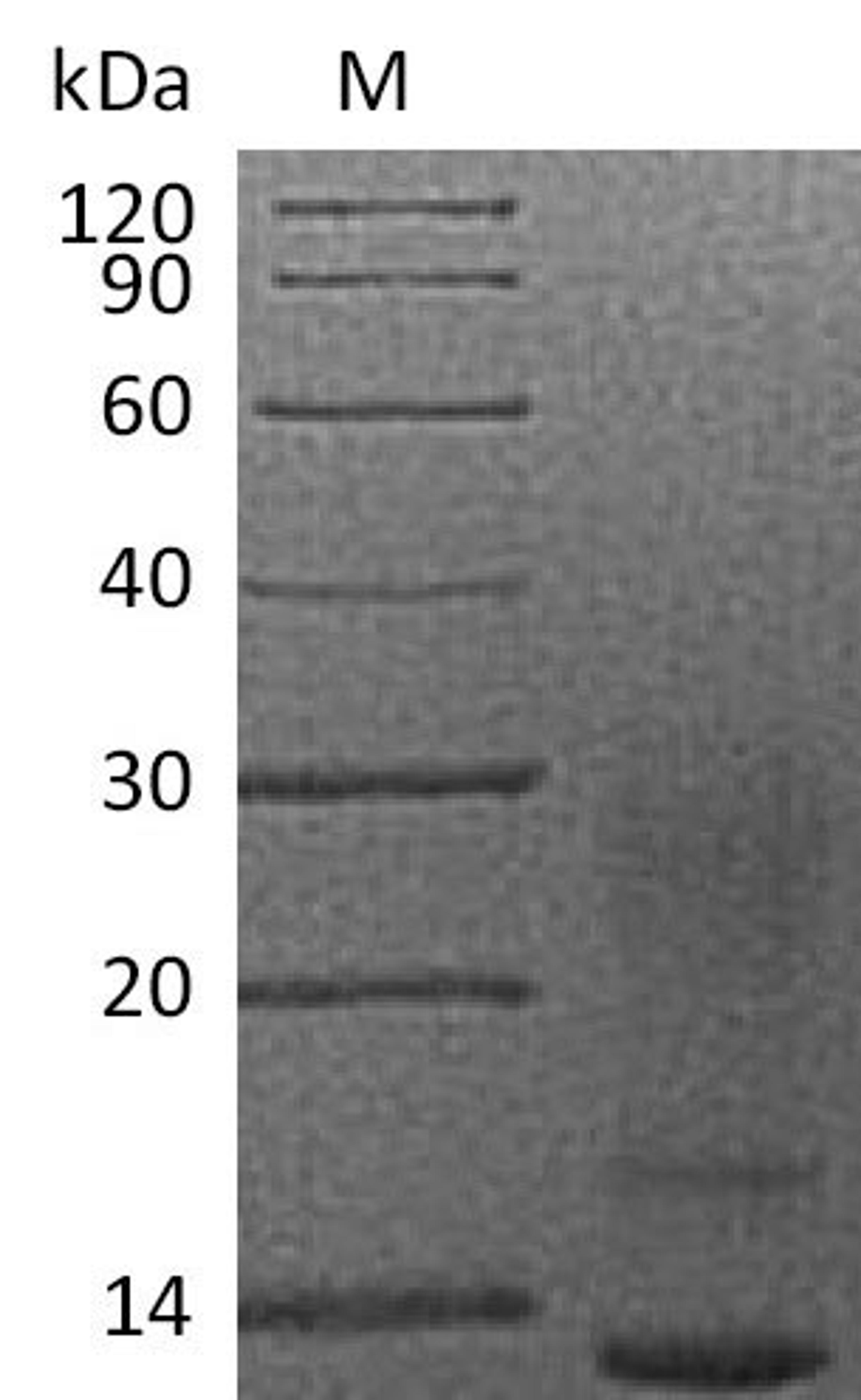 (Tris-Glycine gel) Discontinuous SDS-PAGE (reduced) with 5% enrichment gel and 15% separation gel.