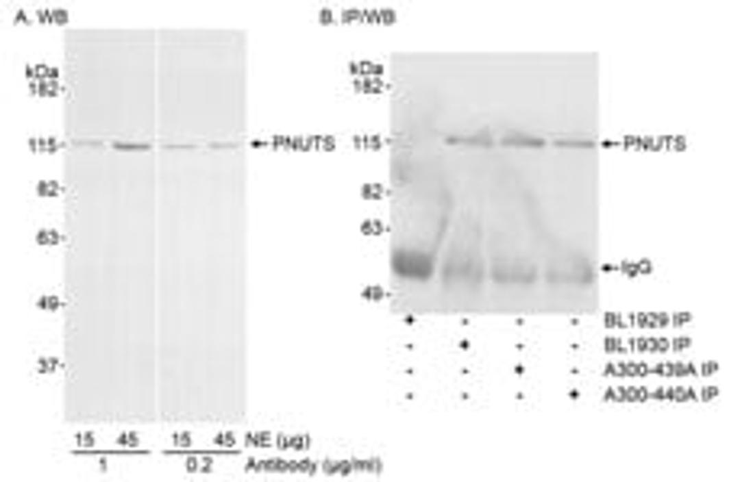 Detection of human PNUTS by western blot and immunoprecipitation.