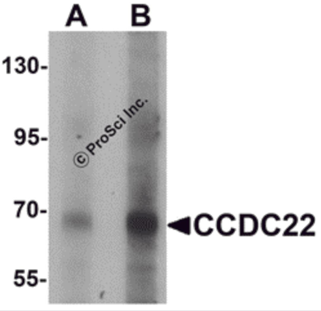 Western blot analysis of CCDC22 in 293 cell lysate with CCDC22 antibody at (A) 1 and (B) 2 &#956;g/mL.