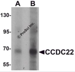 Western blot analysis of CCDC22 in 293 cell lysate with CCDC22 antibody at (A) 1 and (B) 2 &#956;g/mL.