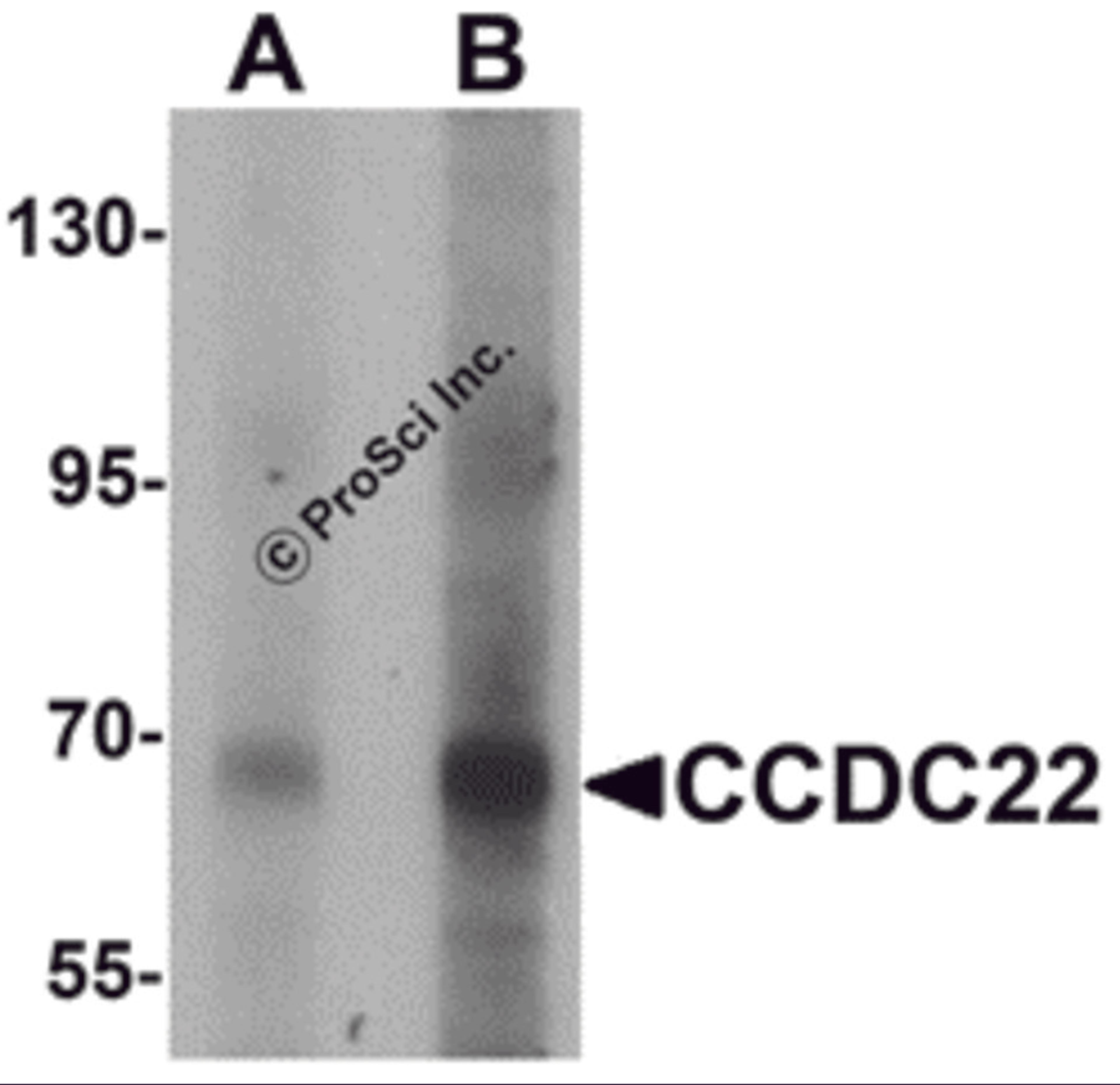 Western blot analysis of CCDC22 in 293 cell lysate with CCDC22 antibody at (A) 1 and (B) 2 &#956;g/mL.