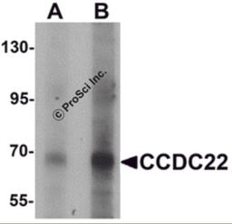 Western blot analysis of CCDC22 in 293 cell lysate with CCDC22 antibody at (A) 1 and (B) 2 μg/mL.