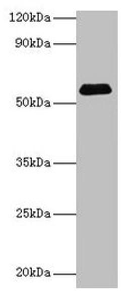 Western blot. All lanes: SUOX antibody at 2µg/ml + Rat liver tissue. Secondary. Goat polyclonal to rabbit IgG at 1/15000 dilution. Predicted band size: 61 kDa. Observed band size: 61 kDa