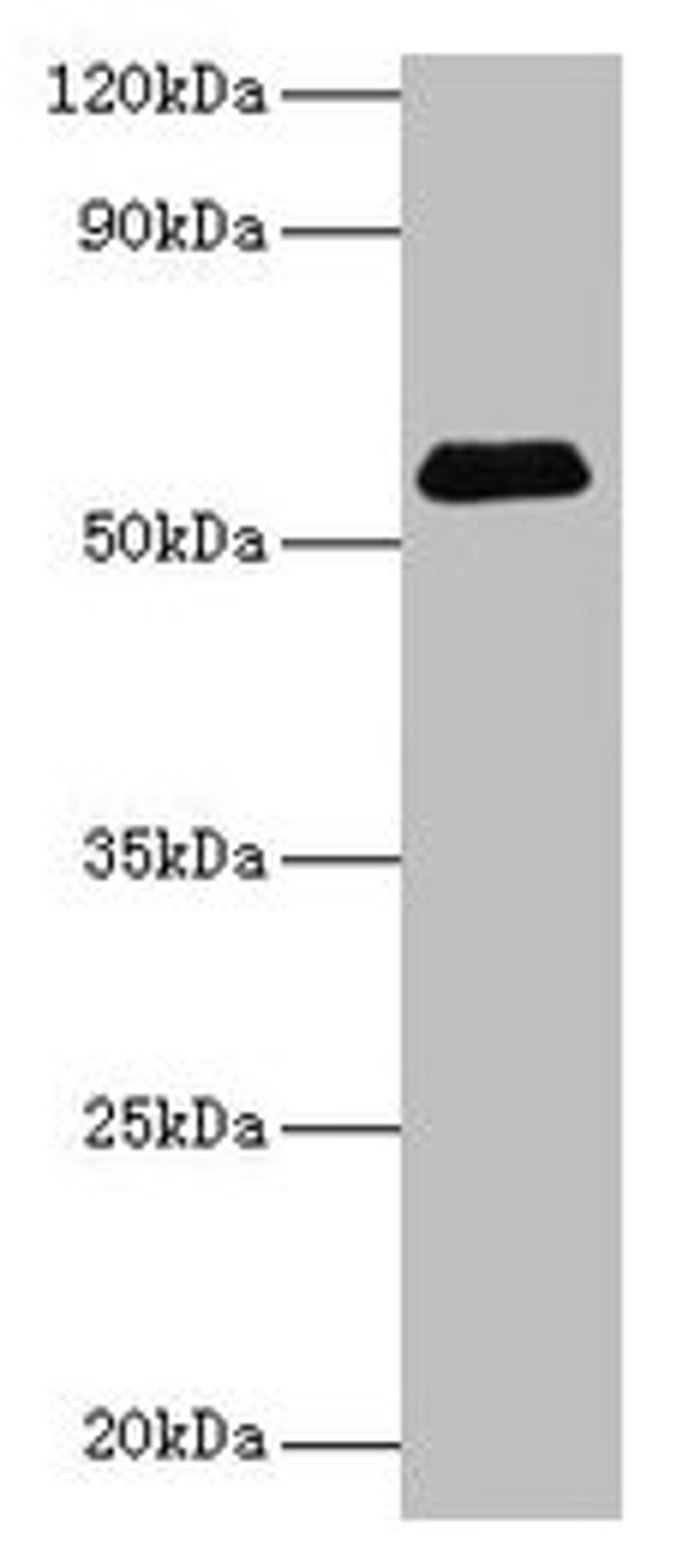 Western blot. All lanes: SUOX antibody at 2µg/ml + Rat liver tissue. Secondary. Goat polyclonal to rabbit IgG at 1/15000 dilution. Predicted band size: 61 kDa. Observed band size: 61 kDa