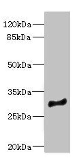 Western blot. All lanes: MLF1 antibody at 2.94ug/ml + Mouse brain tissue. Secondary. Goat polyclonal to rabbit IgG at 1/10000 dilution. Predicted band size: 31, 24, 34, 28, 30 kDa. Observed band size: 31 kDa.
