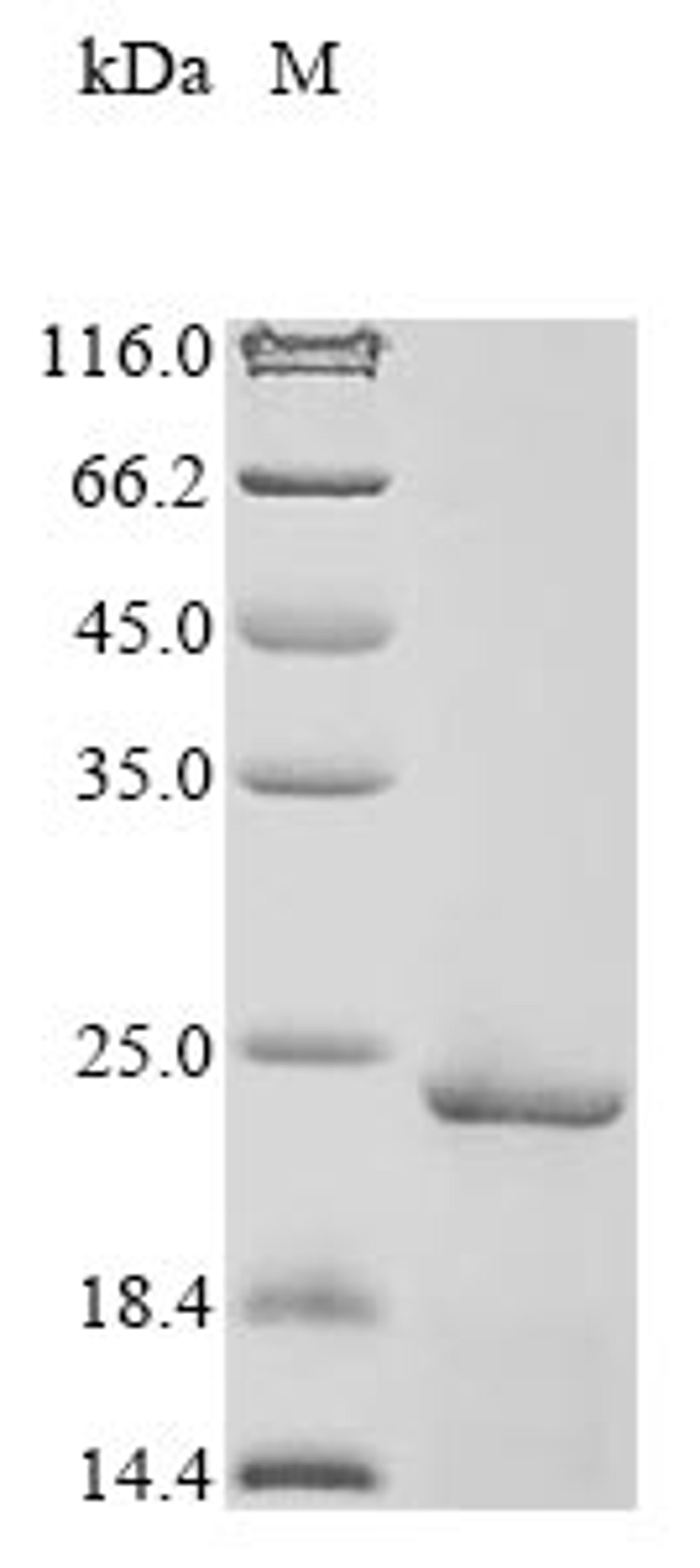 (Tris-Glycine gel) Discontinuous SDS-PAGE (reduced) with 5% enrichment gel and 15% separation gel.