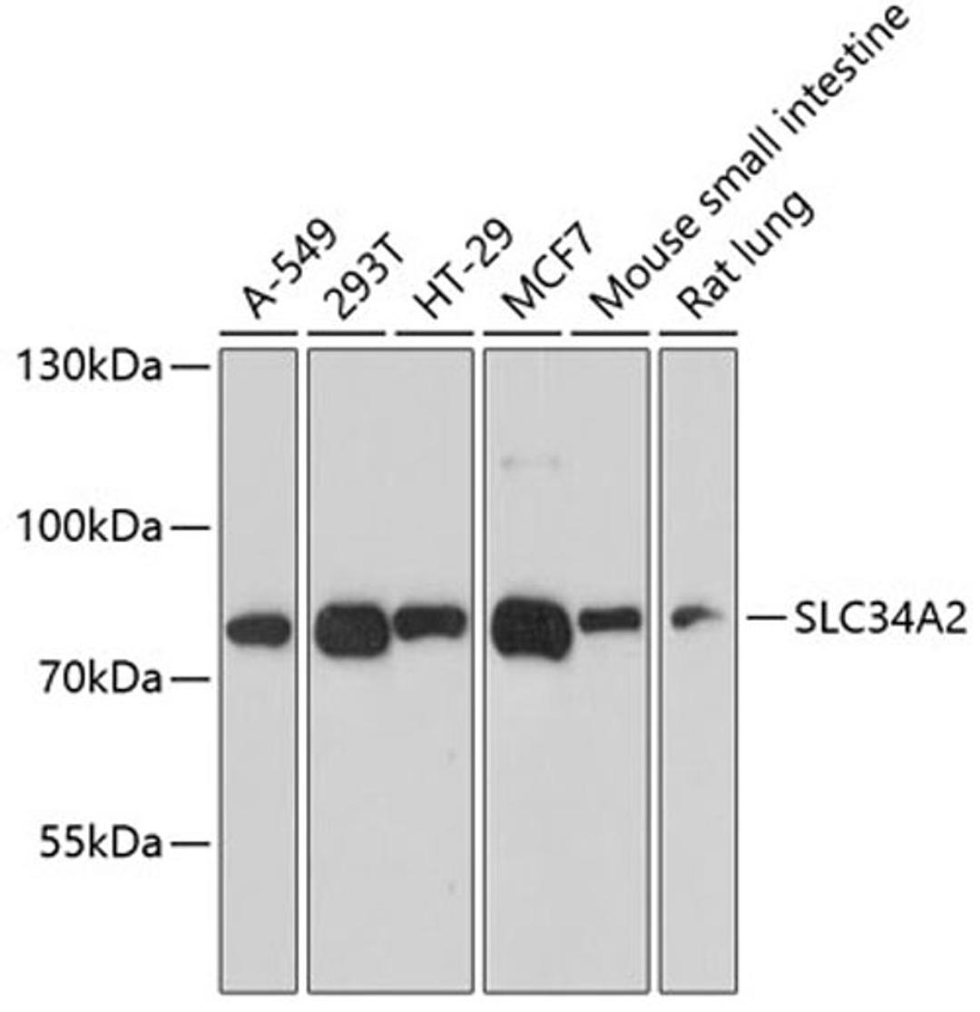 Western blot - SLC34A2 antibody (A9460)