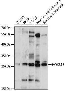 Western blot - HOXB13 antibody (A15779)