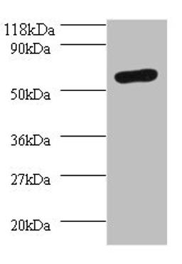Western blot. All lanes: SEPSECS antibody at 2µg/ml + 293T whole cell lysate. Secondary. Goat polyclonal to rabbit IgG at 1/10000 dilution. Predicted band size: 56, 6 kDa. Observed band size: 56 kDa