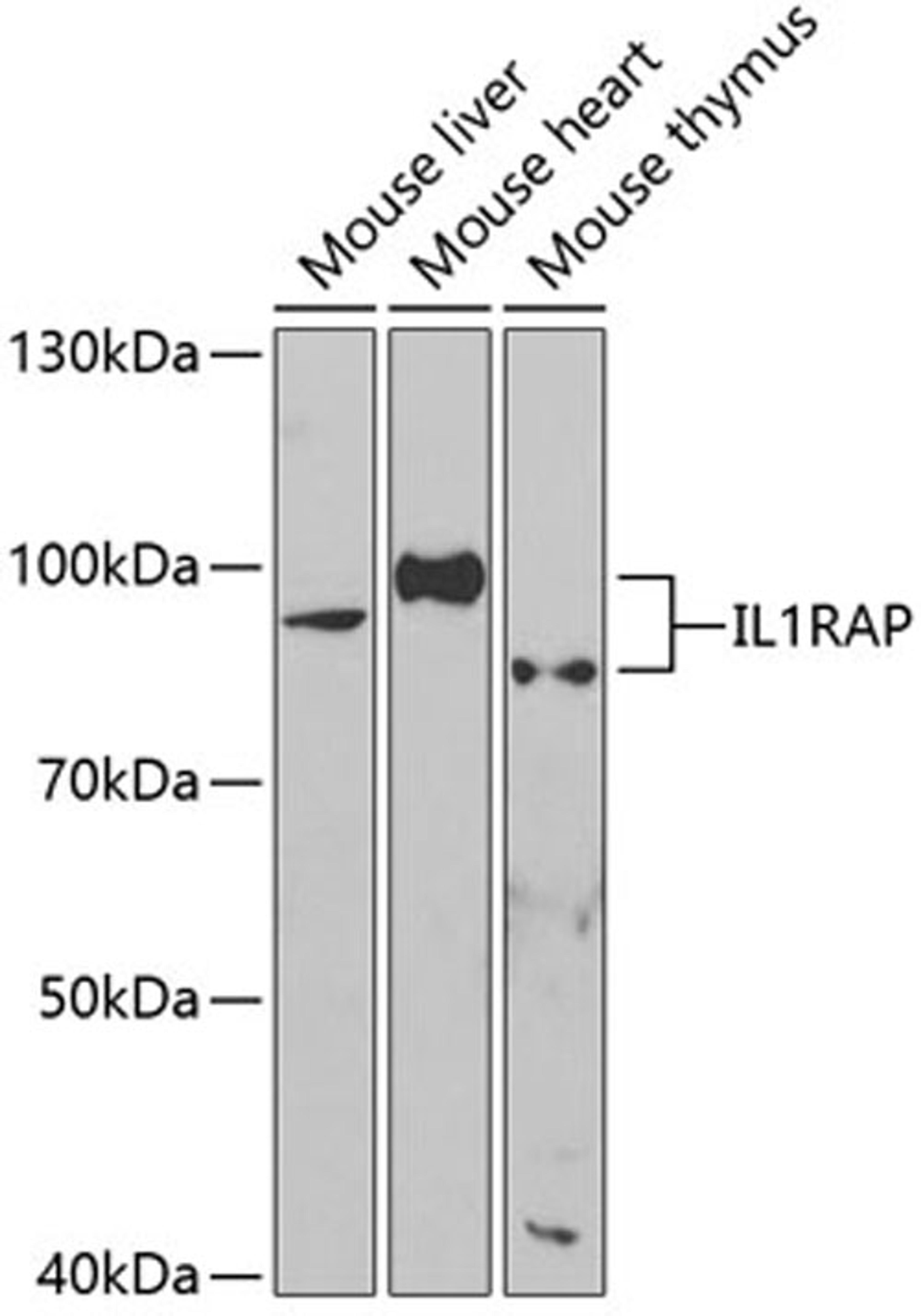 Western blot - IL1RAP antibody (A5349)