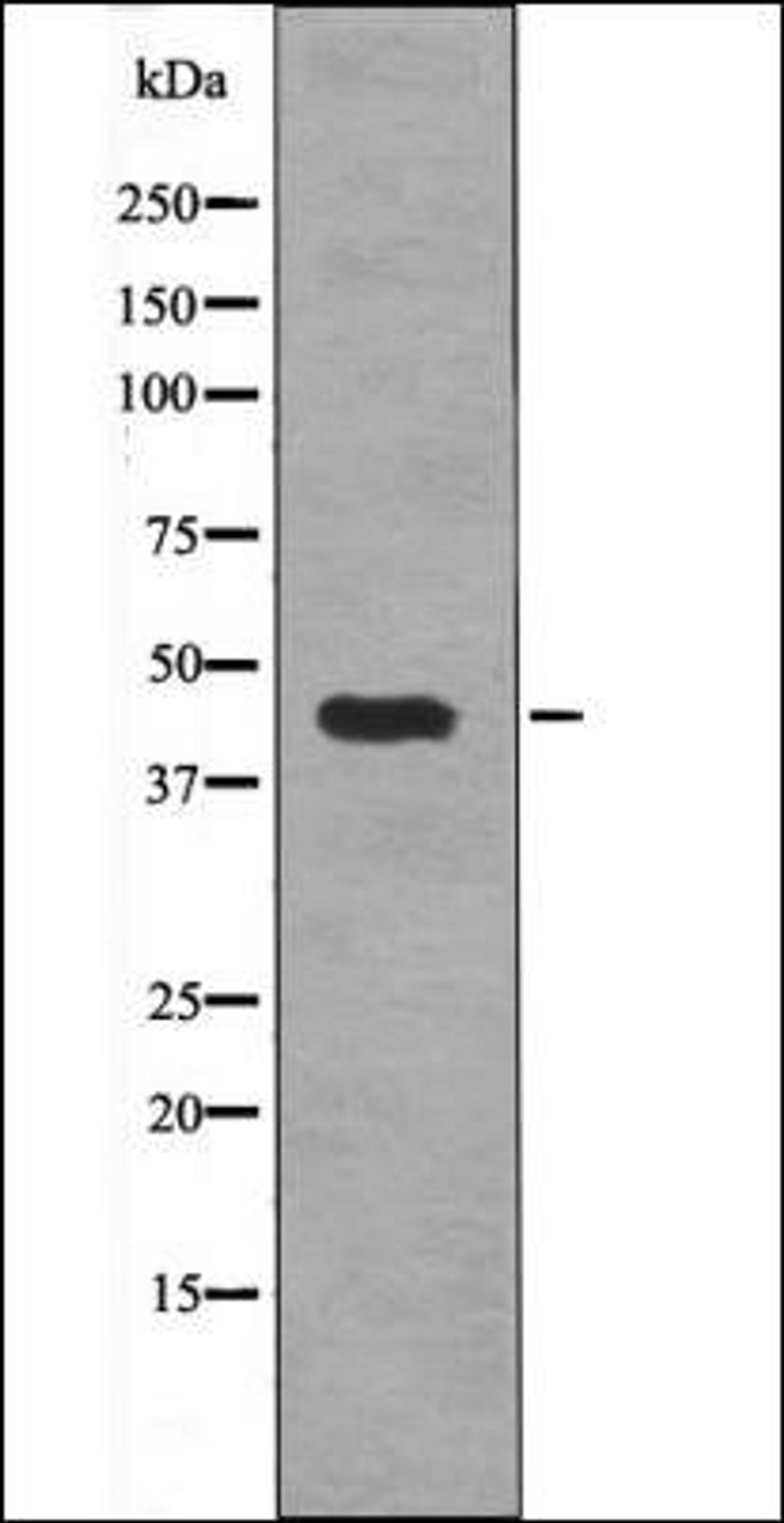 Western blot analysis of Na3VO4 treated HepG2 whole cell lysates using MAP2K1/2 -Phospho-Ser212/216- antibody