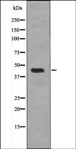 Western blot analysis of Na3VO4 treated HepG2 whole cell lysates using MAP2K1/2 -Phospho-Ser212/216- antibody