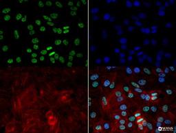 Immunocytochemistry/Immunofluorescence: hnRNP A2B1 Antibody (DP3B3) [NB120-6102] - The hnRNP A2B1 antibody was tested in HeLa cells at a 5ug/ml using a Dylight 488 conjugated secondary antibody (Green). Actin (Red) and DNA (Blue) were counterstained using Phalloidin 568 and DAPI.