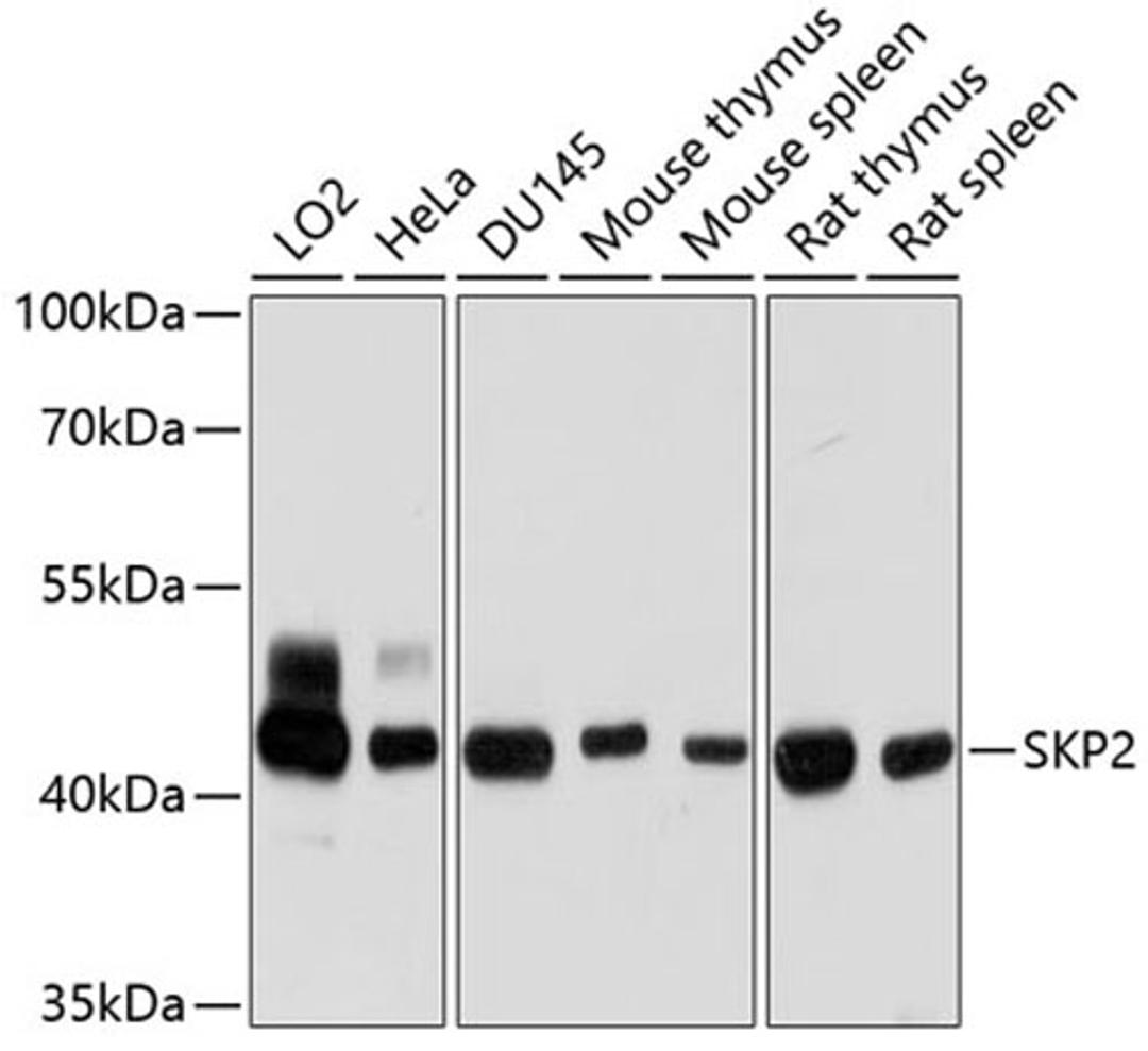 Western blot - SKP2 antibody (A7728)