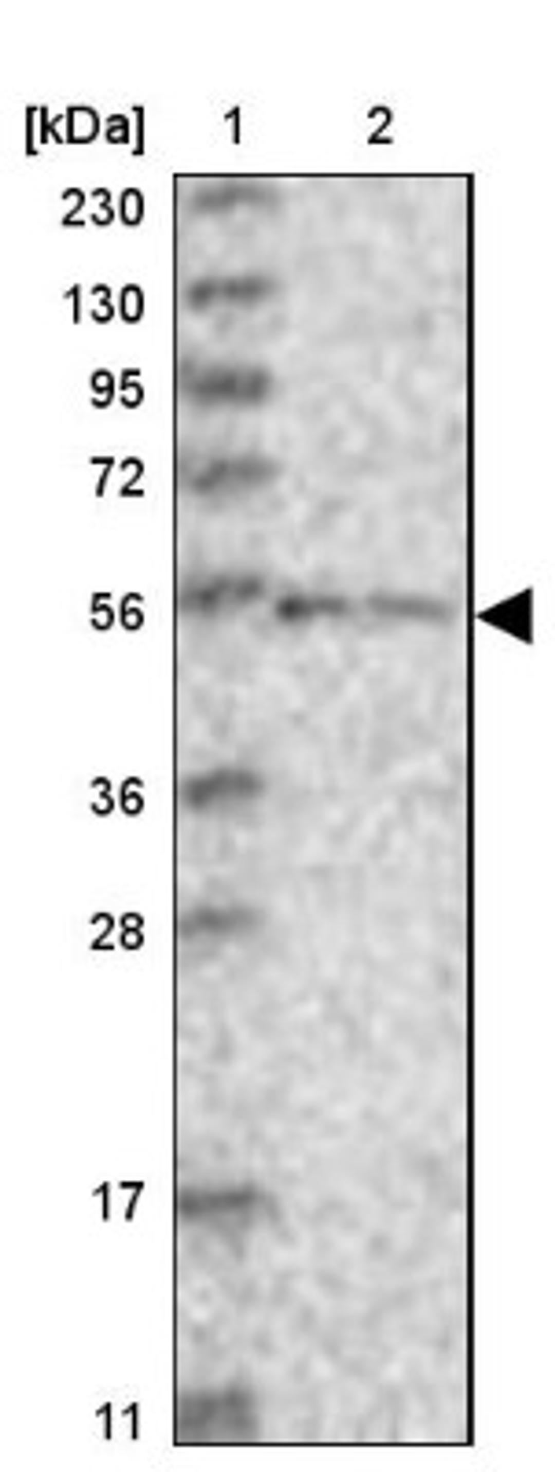 Western Blot: ZNF76 Antibody [NBP1-85323] - Lane 1: Marker [kDa] 230, 130, 95, 72, 56, 36, 28, 17, 11<br/>Lane 2: Human cell line RT-4