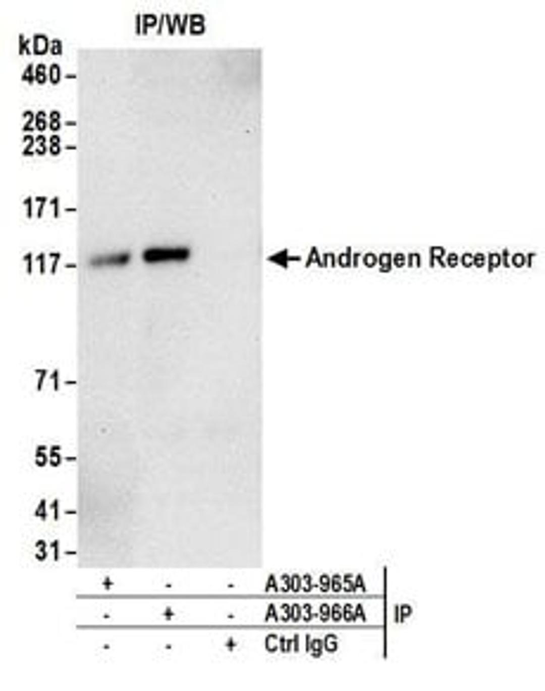 Detection of human Androgen Receptor by western blot of immunoprecipitates.