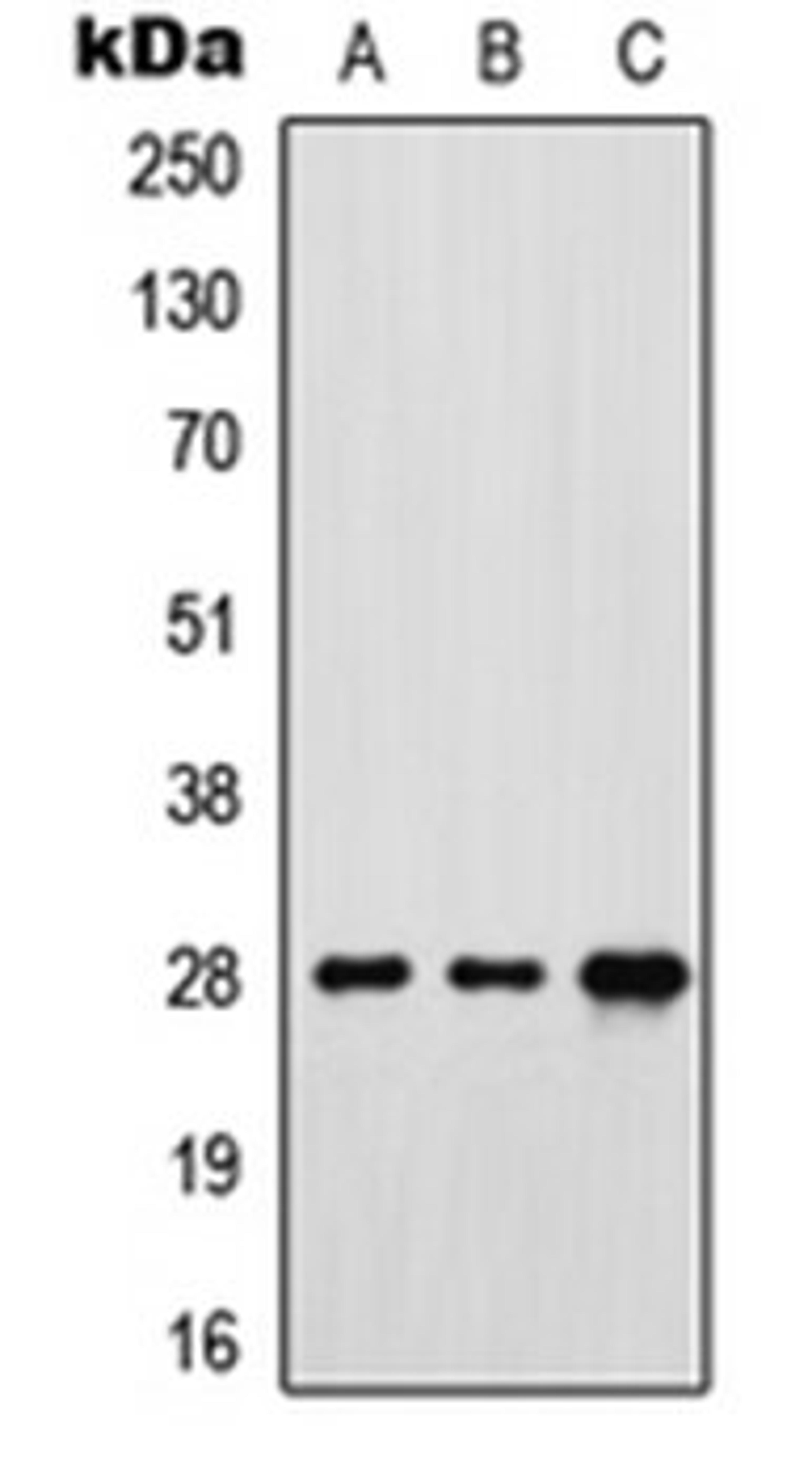 Western blot analysis of MCF7 (Lane 1), SP2/0 (Lane 2), rat brain (Lane 3) whole cell lysates using FOLR3 antibody