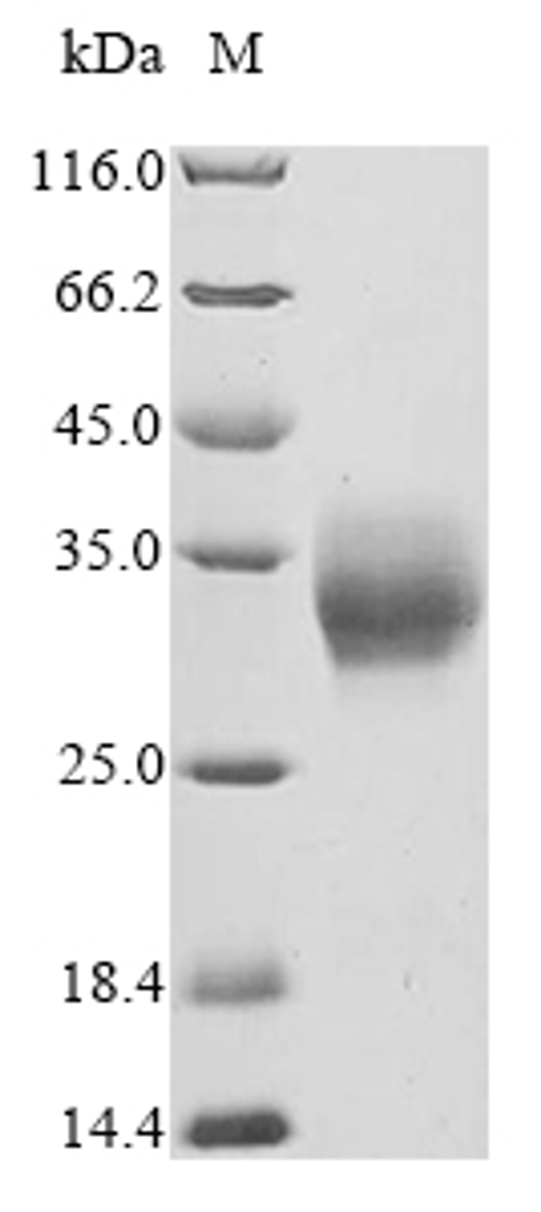 (Tris-Glycine gel) Discontinuous SDS-PAGE (reduced) with 5% enrichment gel and 15% separation gel.