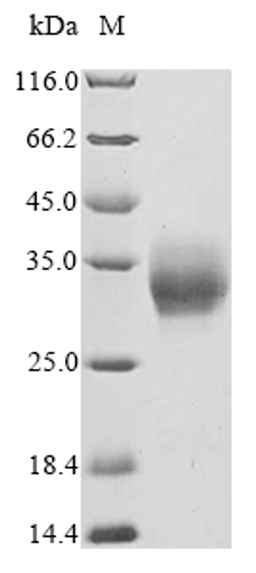 (Tris-Glycine gel) Discontinuous SDS-PAGE (reduced) with 5% enrichment gel and 15% separation gel.