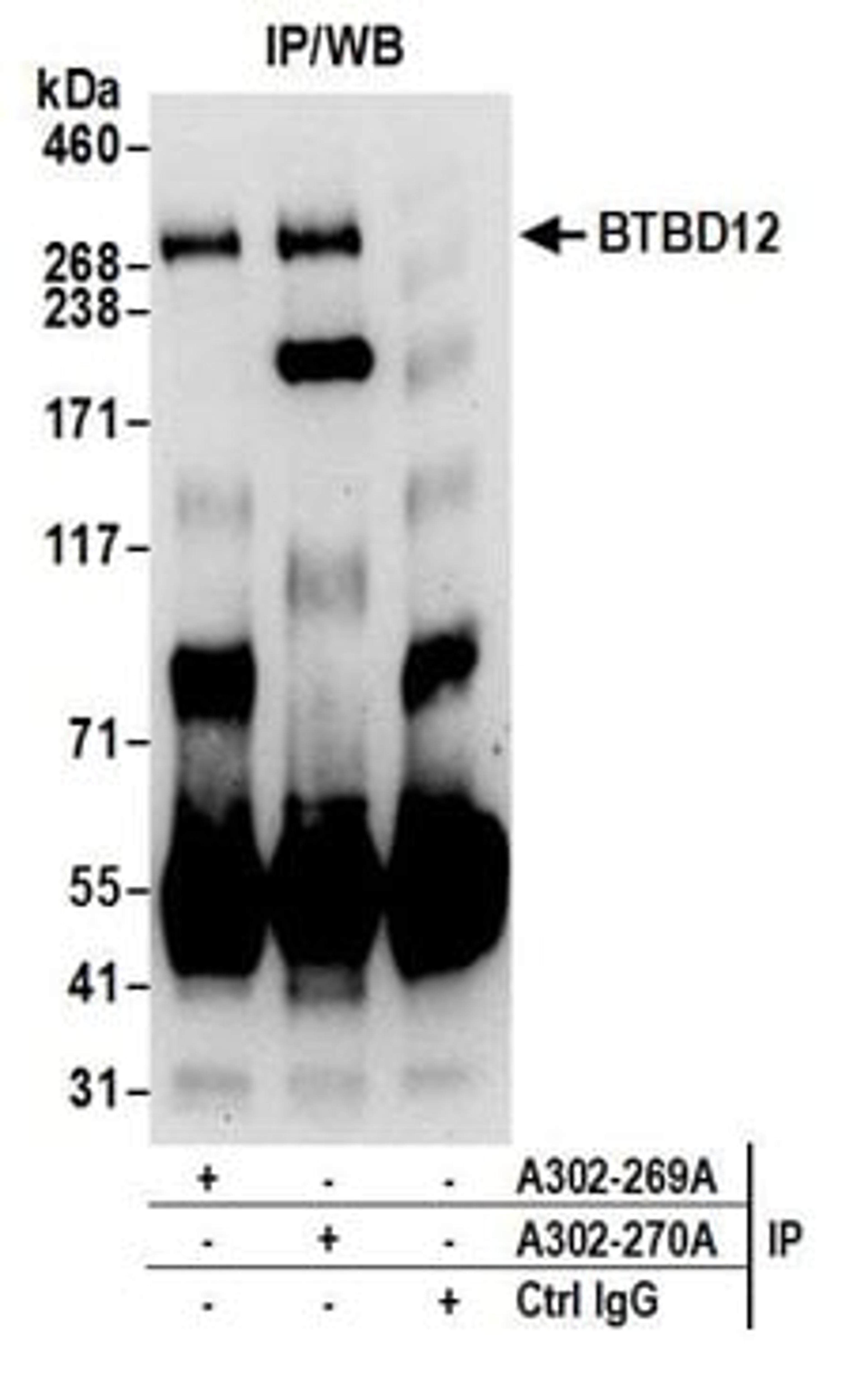 Detection of human BTBD12 by western blot of immunoprecipitates.