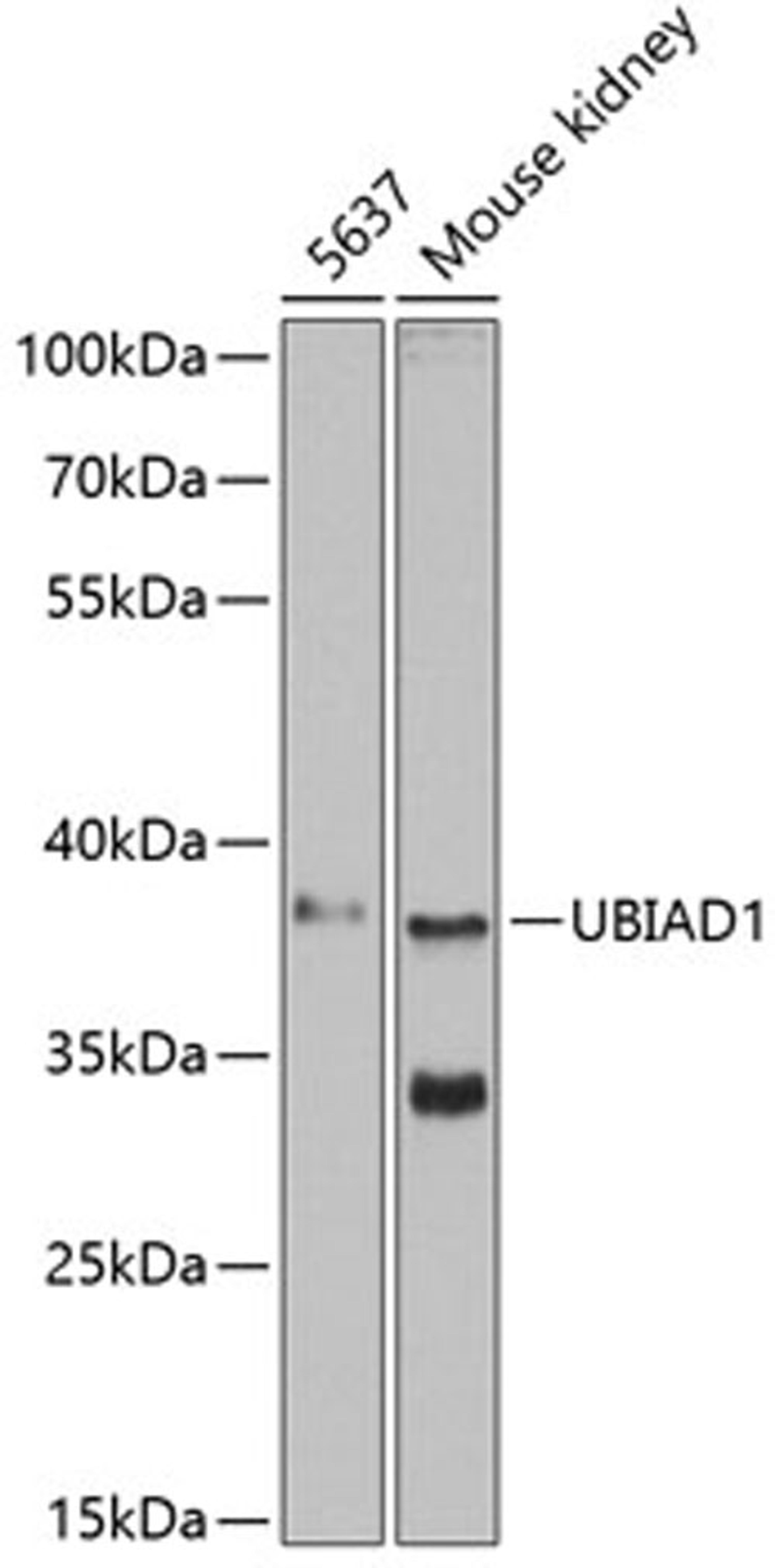 Western blot - UBIAD1 antibody (A13421)